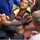 A wounded farmer is assisted by other demonstrators after Friday's mass shooting by security forces in the Philippines. (Photo: Kilab Multimedia)