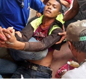 A wounded farmer is assisted by other demonstrators after Friday's mass shooting by security forces in the Philippines. (Photo: Kilab Multimedia)